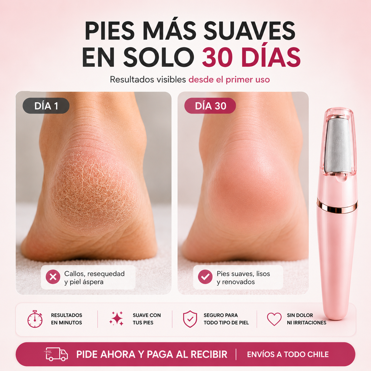 PediSmooth™ Removedor Eléctrico de Callos
