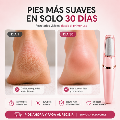 PediSmooth™ Removedor Eléctrico de Callos